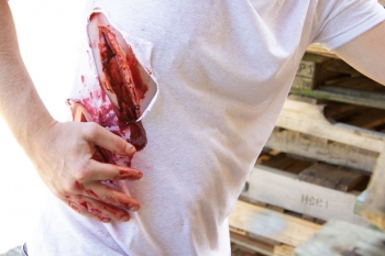 Schnittwunde groß mit Blutungsfunktion