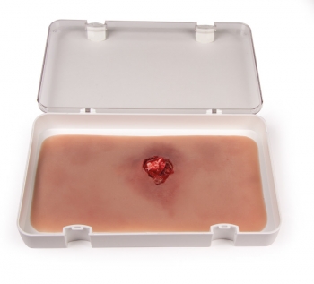 Offener Bruch Arm mit Blutungsfunktion