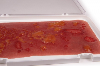 Wundmoulage Verbrennung II. Grades