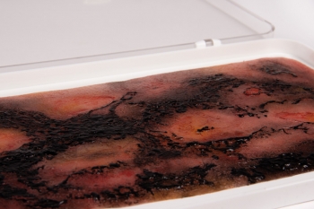 Wundmoulage Verbrennung III. Grades