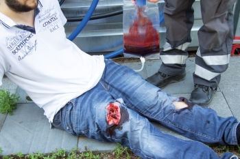 Wundmoulage wound packing