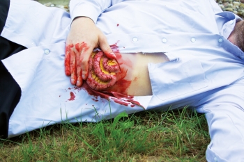 Wundmoulage Dünndarmaustritt