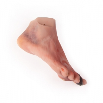 Wundenfuß mit diabetischem Fußsyndrom, für Puppe