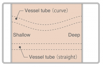 Ultraschall-Gefäß-Übungskissen, 2er Set