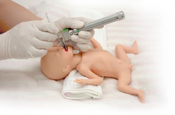 Frühgeborenes mit extrem niedrigem Geburtsgewicht (ELBW)