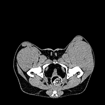 Hundebecken - Phantom für CT und Röntgen