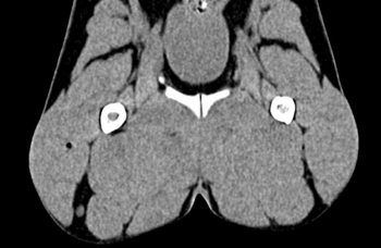 Hundebecken - Phantom für CT und Röntgen