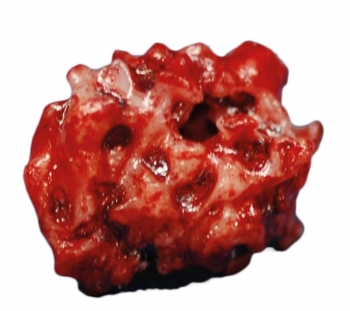 Simulationsset Subsolide Herde, 3D Milchglasherde