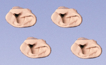 Zusatzohren