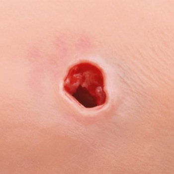 Trainer zur Blutungskontrolle am Arm P102