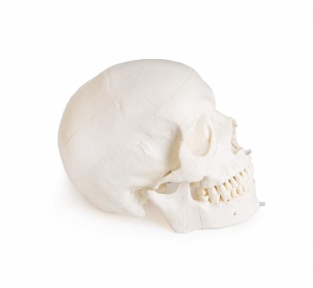 Schädelmodell für Zahnmedizin mit CMD Syndrom, 8-teilig