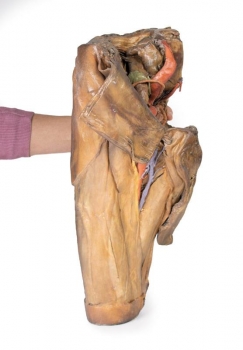 Männliches Hüftgelenk und Oberschenkel