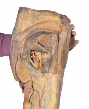 Männliches Hüftgelenk und Oberschenkel