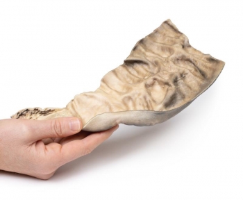 Hirschsprung‘s Krankheit