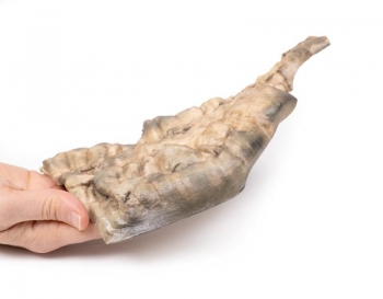 Hirschsprung‘s Krankheit