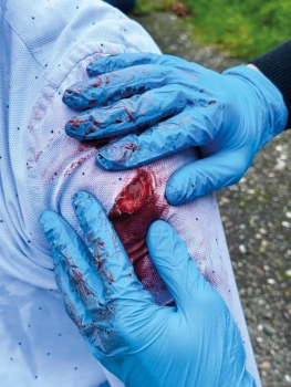 Wundmoulagen - Set Standard