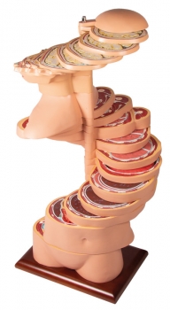 Scheibentorso, natürliche Größe