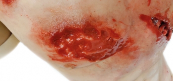 Trauma Training Torso