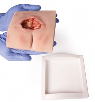 Wundmoulage sakraler Dekubitus gesäubert, mit Stativ