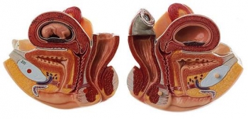 Weibliches Geschlechtsorgan mit 10 Wochen altem Fetus, passt zu  (AS 52)