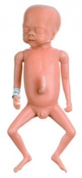 Frühgeborenenbaby, männlich (MS 60)