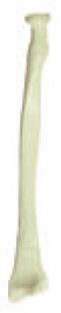 Speiche (Radius) (QS 19/9)