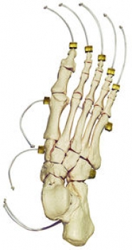 Fuss-Skelett auf Nylon (QS 24-N)
