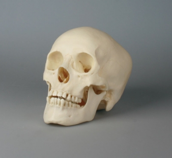 Heranwachsendenschädel, weiblich