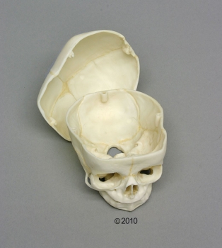 Fetusschädel, 40 Wochen, mit abnehmbarem Schädeldach