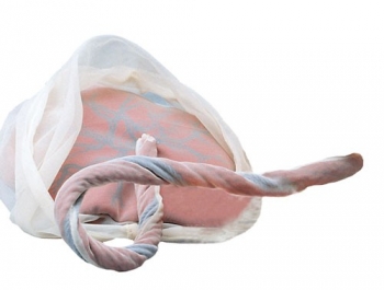 Plazenta und Nabelschnur