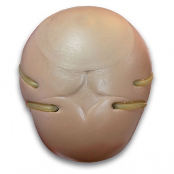 Schädelvenenpunktion für R17700