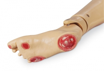 Druckgeschwür-Fuß für GERi und KERi