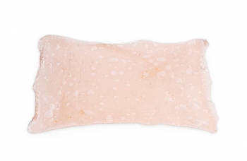 Simulierte Verbrennungen 1. Grades