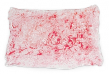 Simulierte Verbrennungen 2. Grades (oberflächlich)