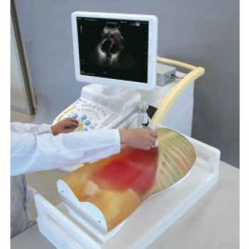 FAST-Ultraschall-Untersuchungsmodell