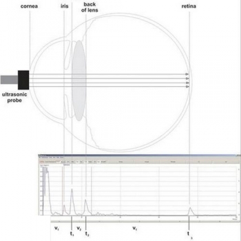 Augenmodell für Ultraschallbiometrie