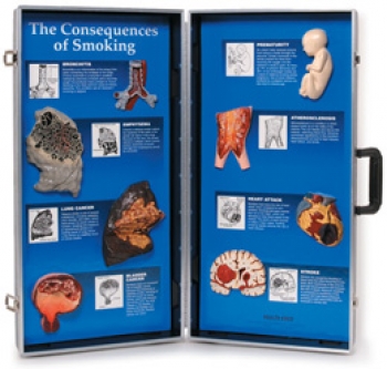 Die Folgen des Rauchens - 3D-Display