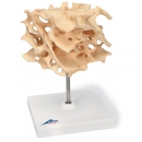 Knochenspongiosa (Schwammknochen) - 100-fach vergrößertes Replikat