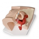 Gynäkologischer Trainer zur Patientenaufklärung