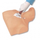 Intraossäre Infusion, Erwachsener