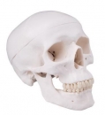 Skelett: Schädel mit Bohrung A10/1,A12/1