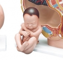 Ersatz Fetus für L20