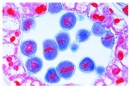 Mitose und Meiose Serie II