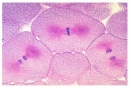 Mitose und Meiose Serie II