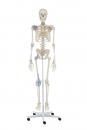 Skelett mit Bandapparat, Otto