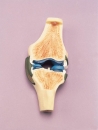 Gelenkschnitt - Modell des Knies