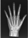 Röntgenphantom Hand, opak