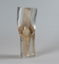 Röntgenphantom Knie transparent