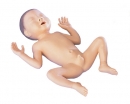 Frühgeborenen-Modell