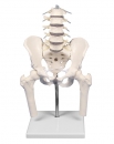 Lendenwirbels&auml;ule mit Becken zur Fehlstellungsdemonstration
